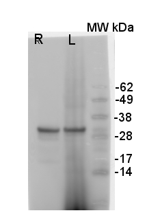 western blot using goat and-V-ATPase antibodies